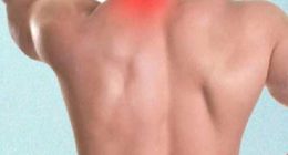 Fibromiyalji Nedir, Nasıl Tedavi Edilir?
