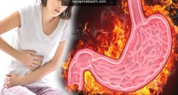 Gastrit nedir? Gastritin belirtileri nelerdir ve tedavisi var mıdır? Gastrite ne iyi gelir?